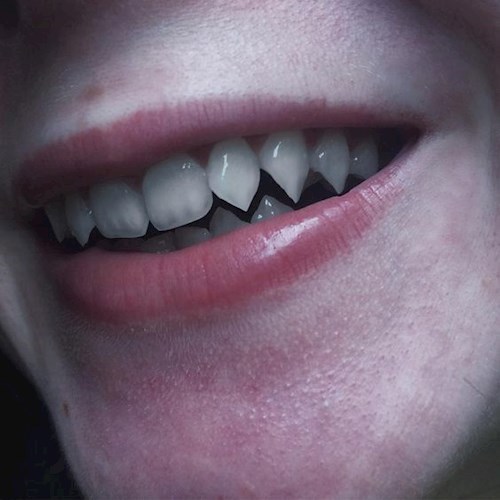 Затем Лёшу съели волки