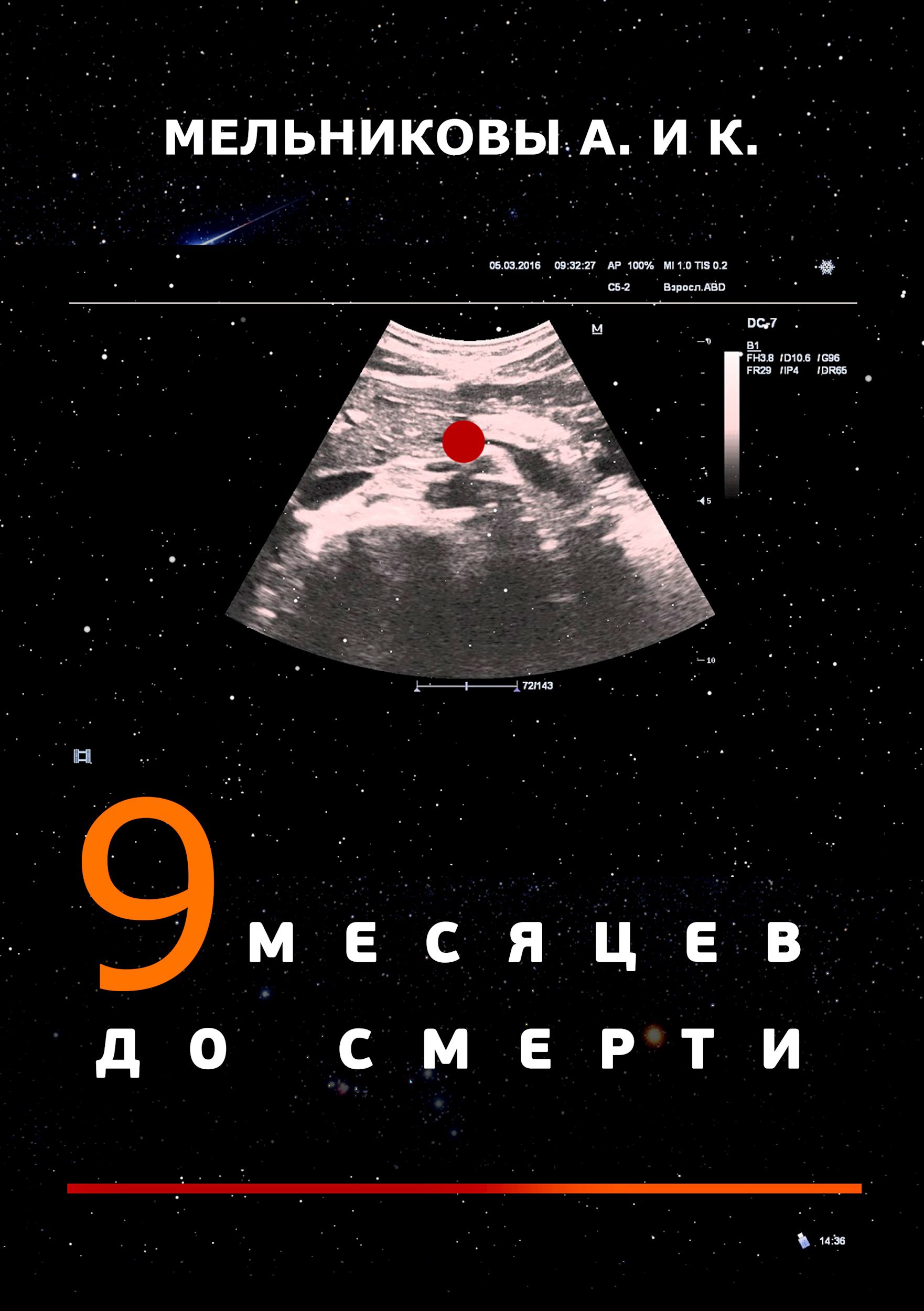 9 месяцев до смерти