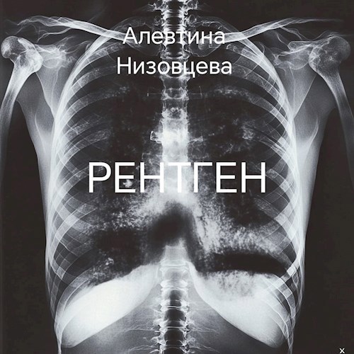 Рентген