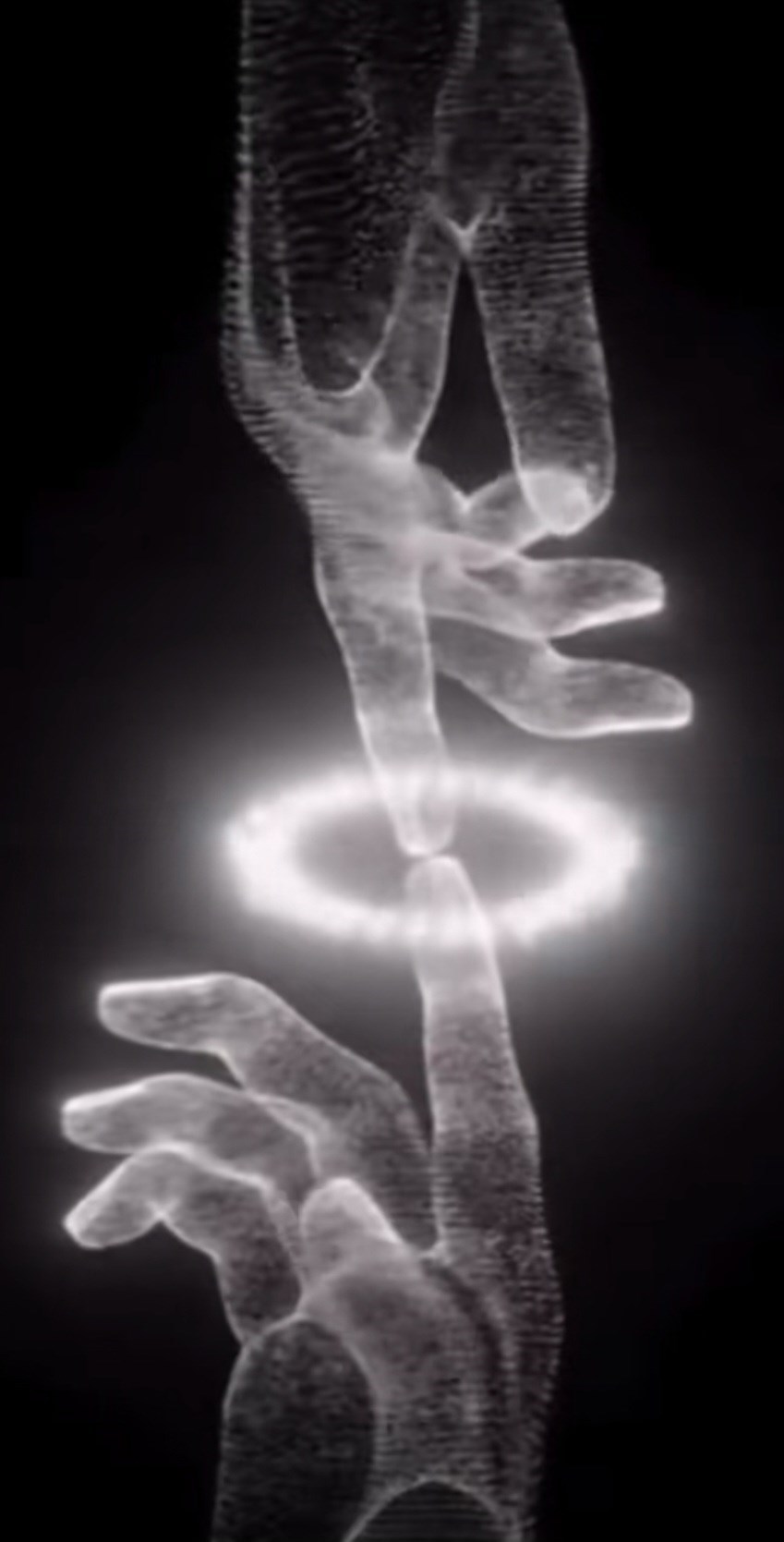 Синдром чужой руки