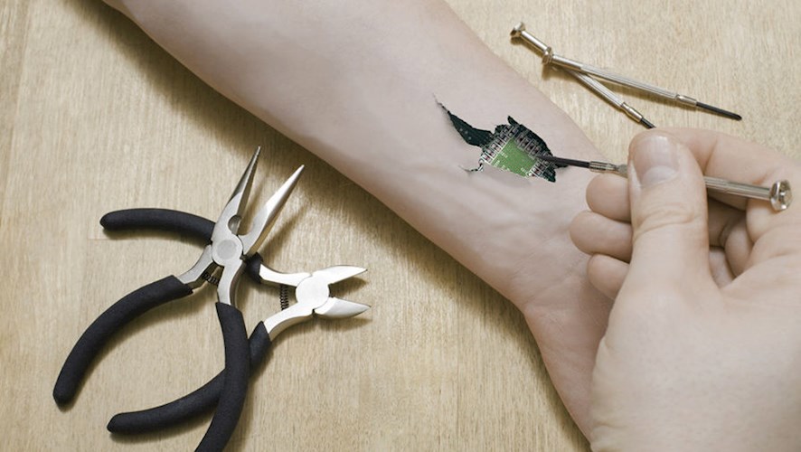 Чип на руку