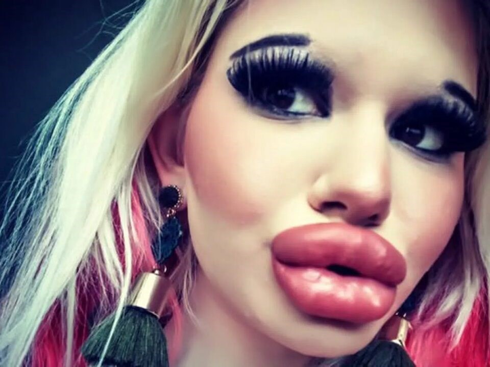 Недоженщина