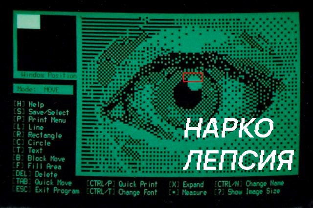 Нарколепсия