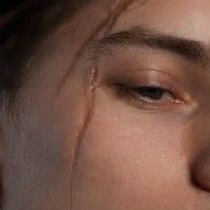 Девушка со шрамом